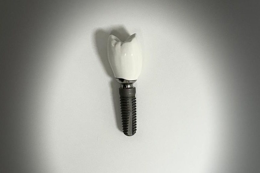 Implantologie Ein schwarzes, weißes Implantat