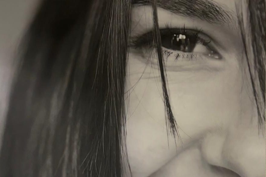 Ästhetische Gesichtschirurgie Nahaufnahme eines lächelnden Gesichts mit langen, dunklen Haaren.