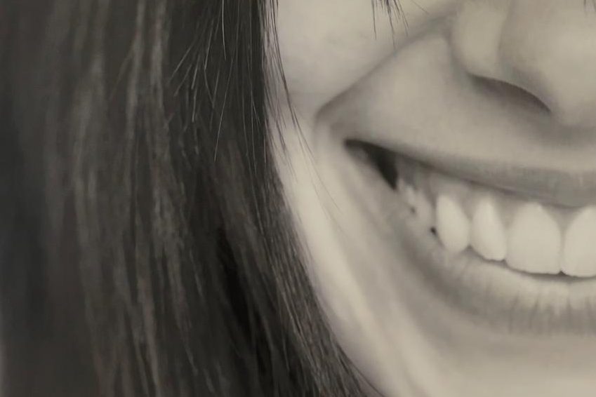 Kieferchirurgie Lächelndes Gesicht mit strahlenden Zähnen und langen, dunklen Haaren.